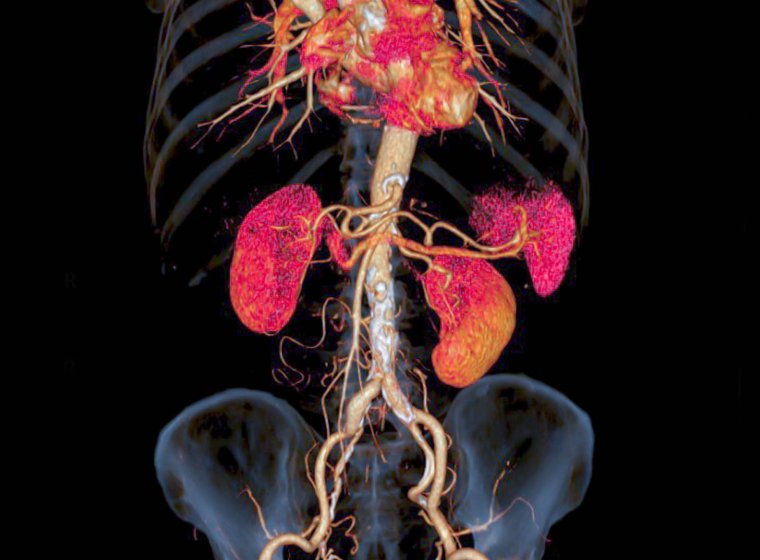 Improving Accuracy of Urologic Cancer Diagnosis 